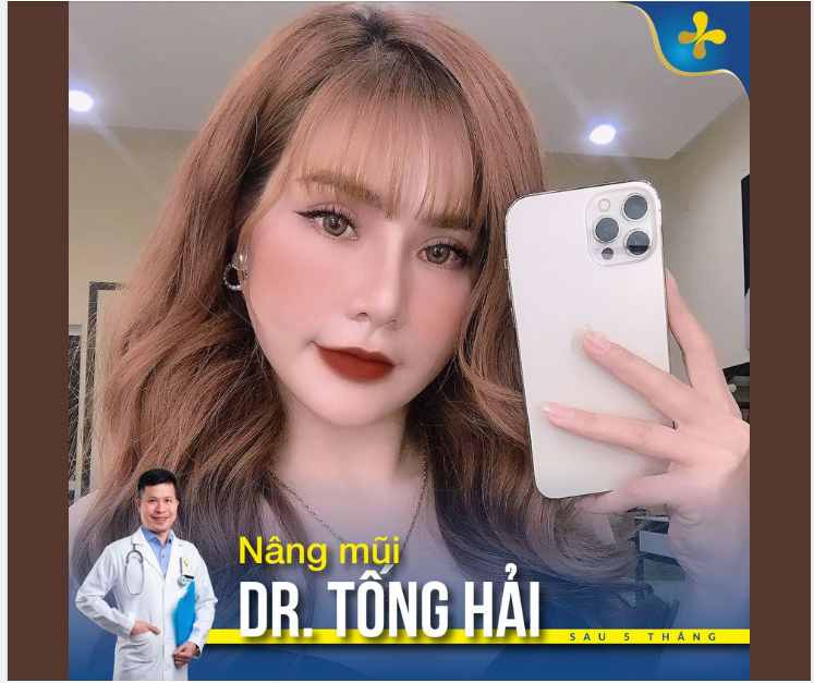 Nàng chưa ưng dáng mũi hiện tại của mình