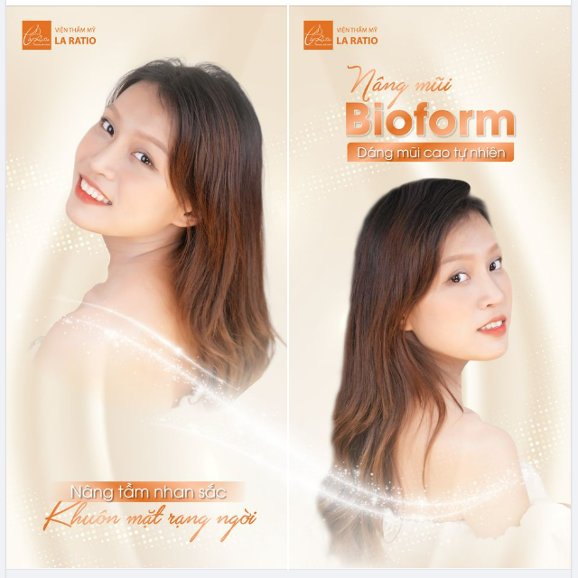Nâng Mũi Bioform ĐỘC QUYỀN từ Viện Thẩm Mỹ La Ratio