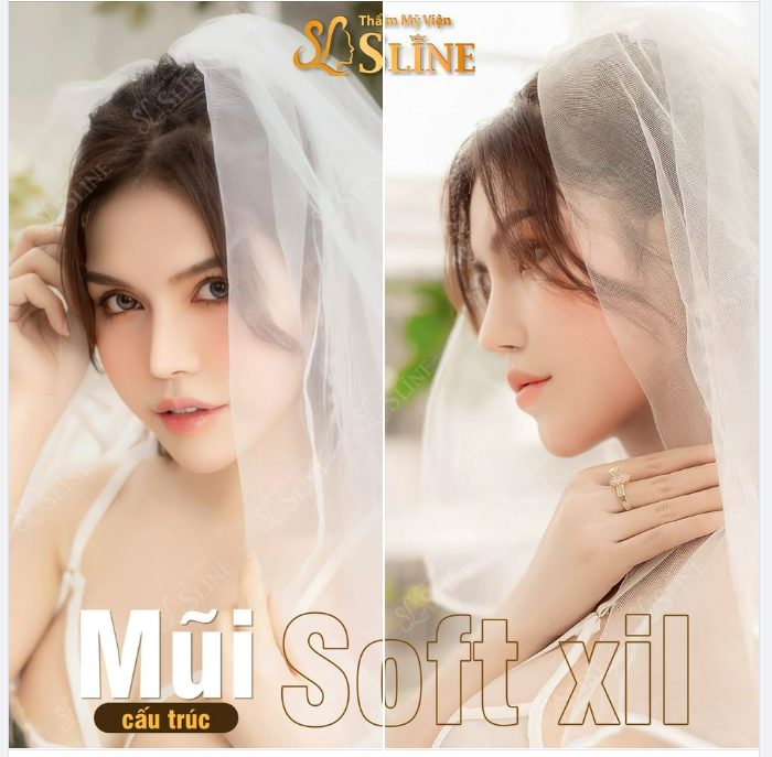 Nâng mũi  Chỉ từ 14tr. Chương trình áp dụng cho 10 suất đăng ký sớm nhất trong tháng này