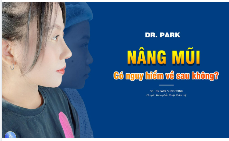 NÂNG MŨI CÓ NGUY HIỂM VỀ SAU KHÔNG