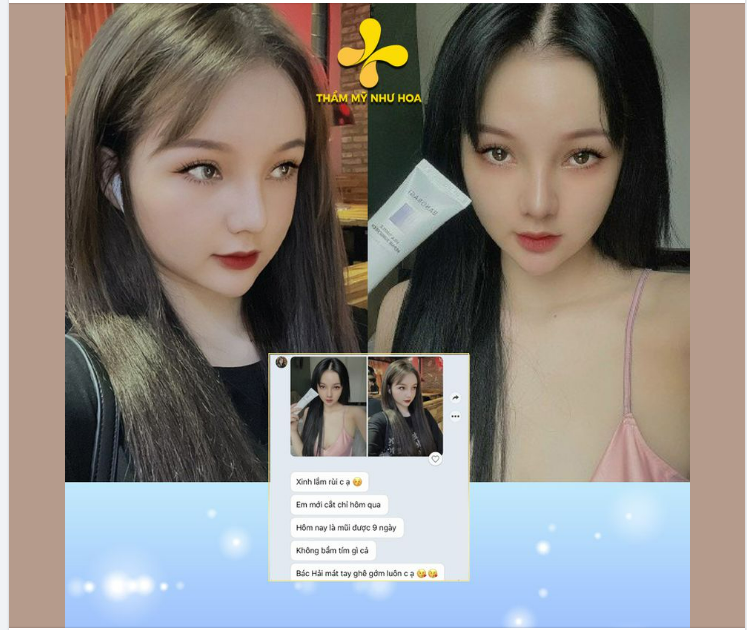 NÂNG MŨI GOLDEN LINE - FEEDBACK CỦA KHÁCH HƠN MỌI LỜI QUẢNG CÁO