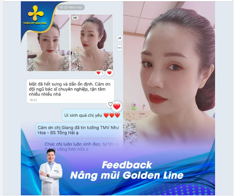 NÂNG MŨI KHÔNG CHỈ ĐỂ XINH, NÂNG MŨI LÀ ĐỂ CHỤP ẢNH KHÔNG KIÊNG GÓC NÀO