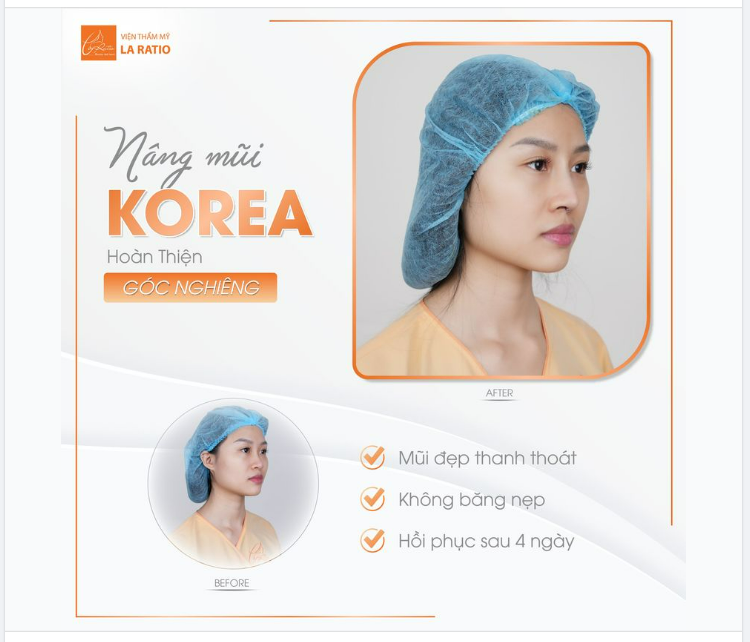 NÂNG MŨI KOREA – XÓA BỎ TỰ TI MŨI NGẮN, HẾCH