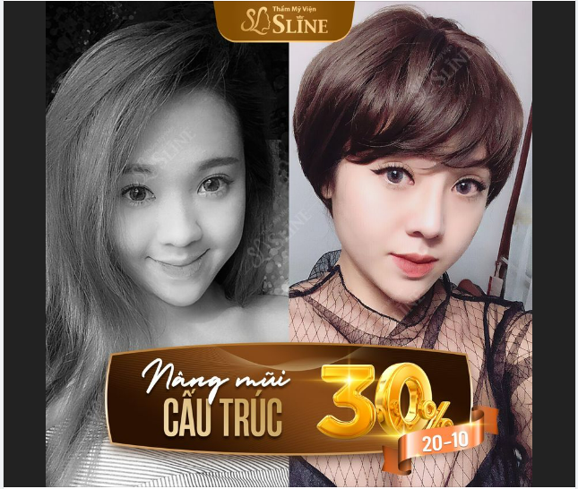 Nâng mũi tại Thẩm Mỹ Viện Sline 36A Lý Nam Đế