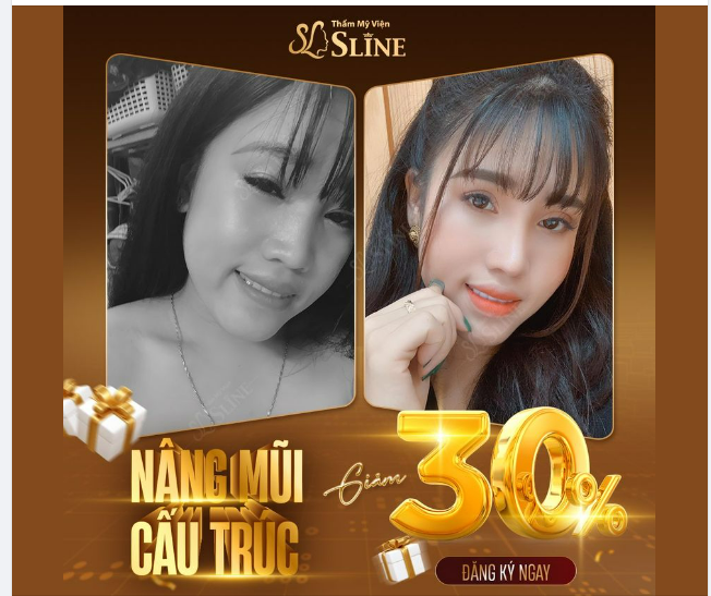 NÂNG MŨI THÁNG 10