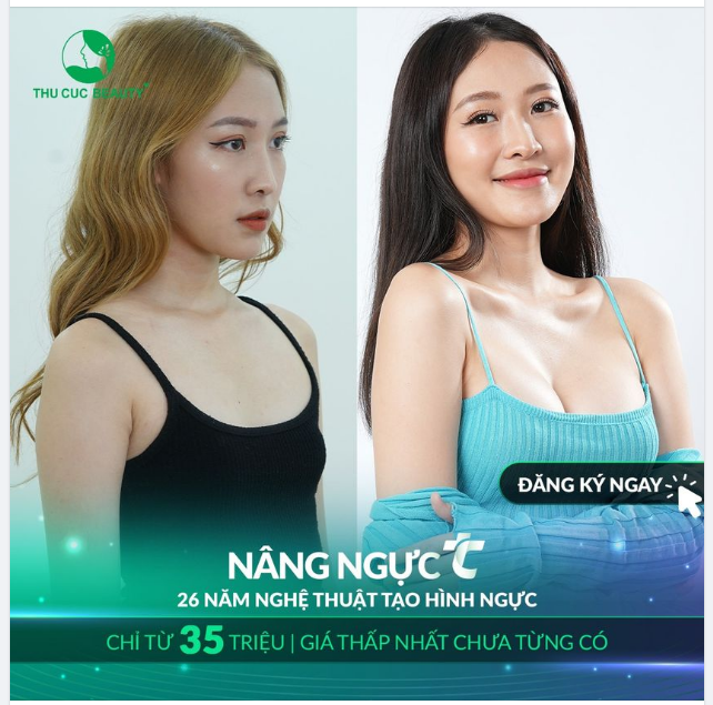 Nâng ngực TC chỉ từ 35TR GIÁ THẤP NHẤT CHƯA TỪNG CÓ