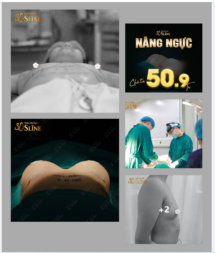 Nâng ngực trọn gói 50,9tr Không phát sinh chi phí – bảo hành miễn phí trọn đời.