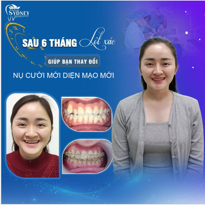 Nâng niu nụ cười xinh