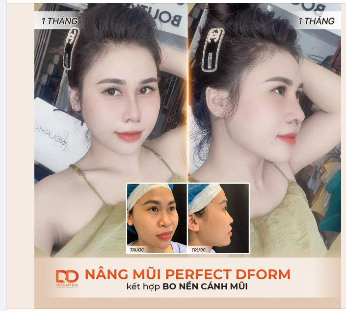 Nếu không nhìn vào khuôn miệng thì sẽ không nhận ra đây là cùng 1 người.