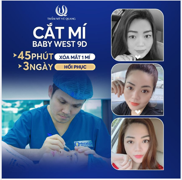Ngỡ ngàng nếp mí đẹp xuất sắc sau khi Cắt mí Baby West 9D