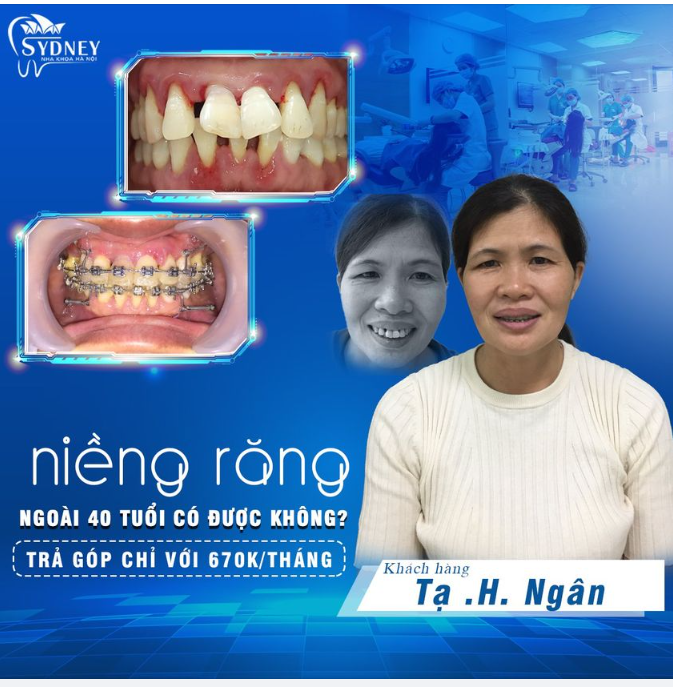 Ngoài 40 tuổi có niềng răng được không?
