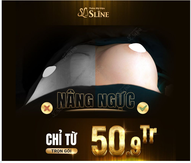 NGỰC ĐẸP chỉ với 50,9tr trọn gói.