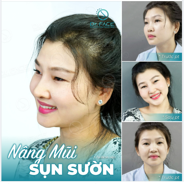 Người gì mà quá dễ thương Nhìn thôi đã muốn chở che suốt đời…!