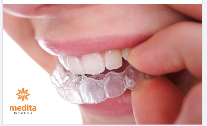 Nha khoa Thẩm mỹ Medita - Cười tự nhiên, duyên rạng ngời!