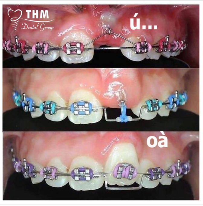 NHA KHOA THẾ HỆ MỚI - TỰ TIN TRAO NỤ CƯỜI XINH