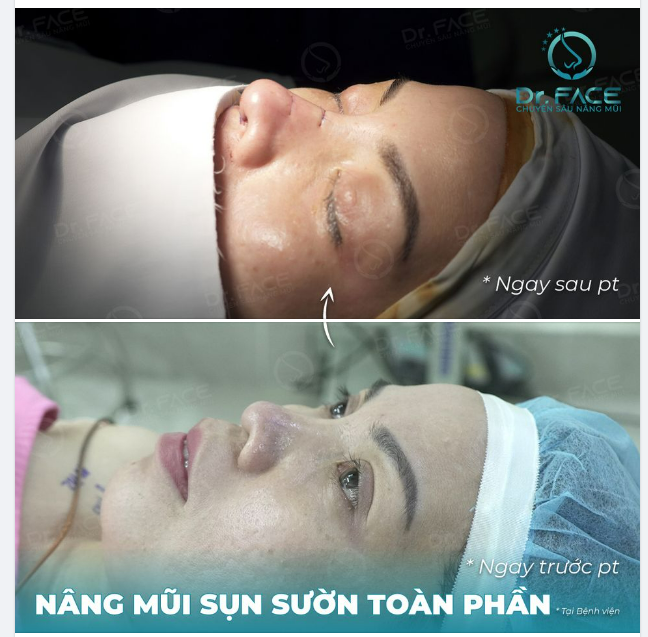 NHÀ KHÔNG CÓ GÌ NGOÀI MŨI ĐẸP…