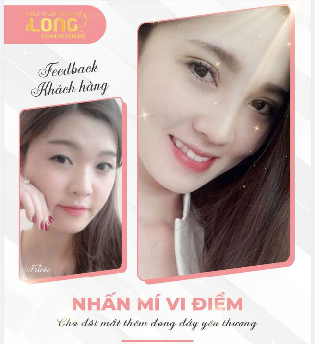 NHẤN MÍ HÔM NAY NHẬN NGAY ƯU ĐÃI KHỦNG