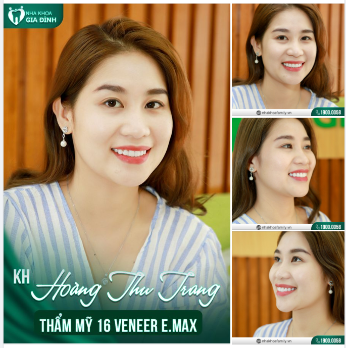NHAN SẮC KHÔNG MIỄN PHÍ, PHỤ NỮ THÔNG MINH HẲN BIẾT CÁCH LÀM GÌ ĐỂ ĐẸP