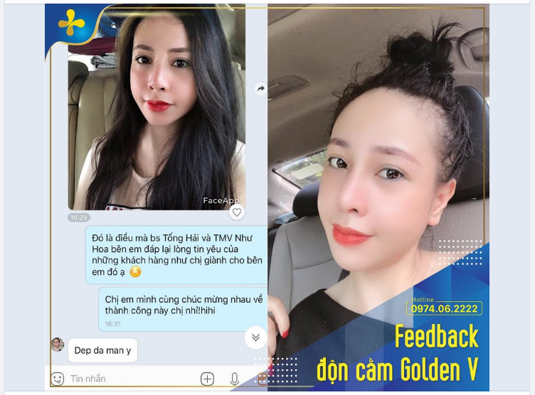 NHAN SẮC RẠNG NGỜI XINH ĐẸP SAU 1 THÁNG ĐỘN CẰM