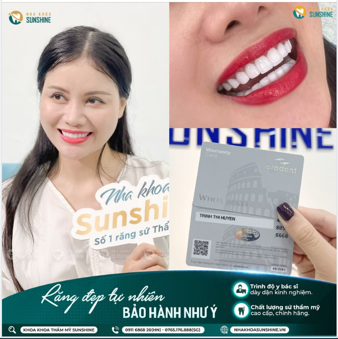 Những lo lắng của khách hàng khi làm răng sứ thẩm mỹ