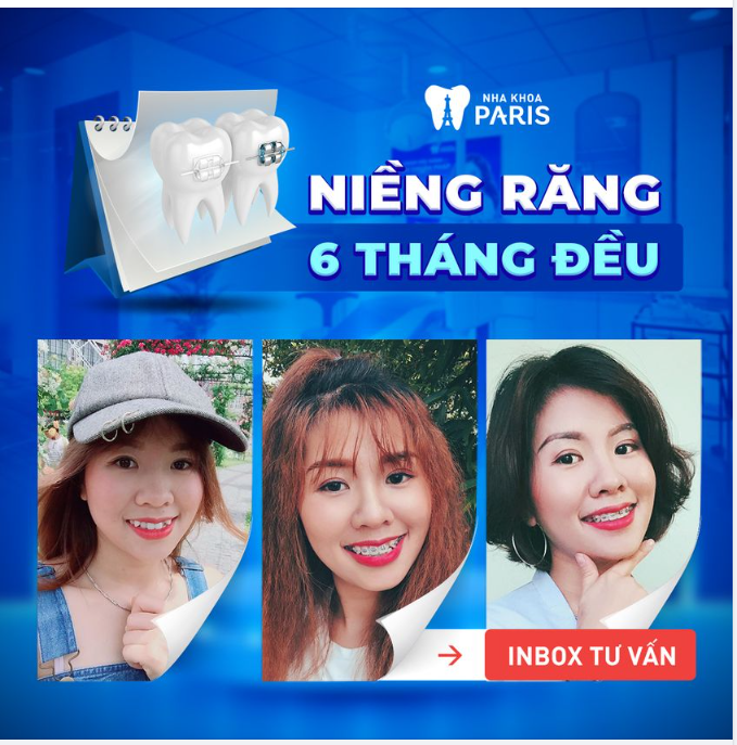 Niềng Răng Chuẩn Bệnh Viện Răng - Hàm - Mặt