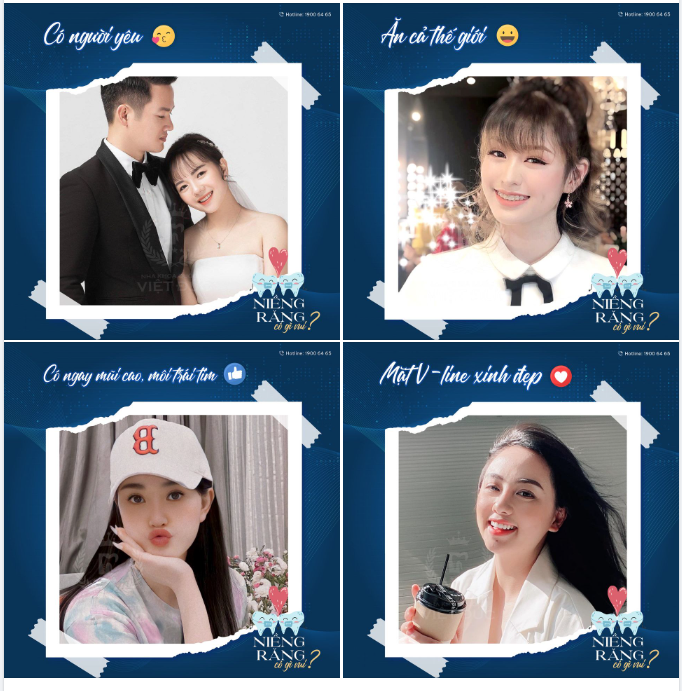 NIỀNG RĂNG CÓ GÌ VUI?