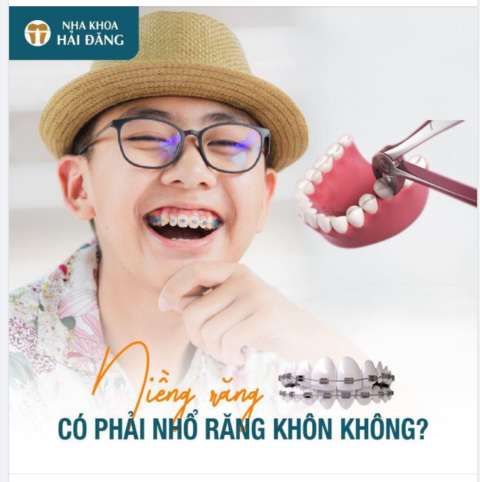 NIỀNG RĂNG CÓ PHẢI NHỔ RĂNG KHÔN KHÔNG?