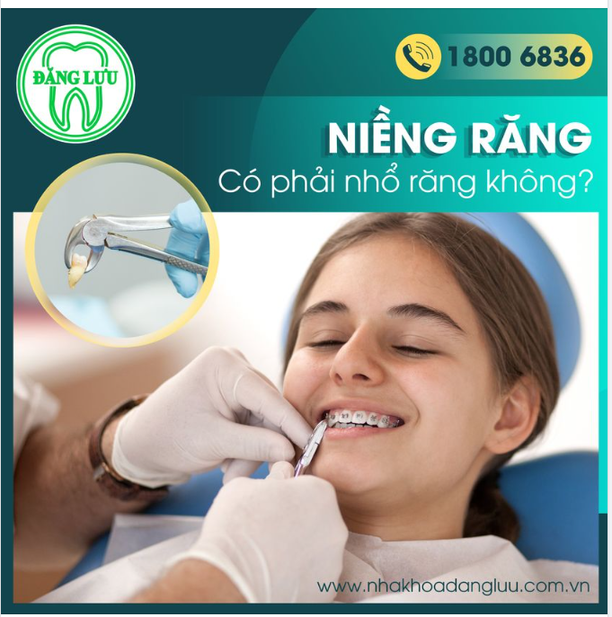 NIỀNG RĂNG CÓ PHẢI NHỔ RĂNG KHÔNG ?