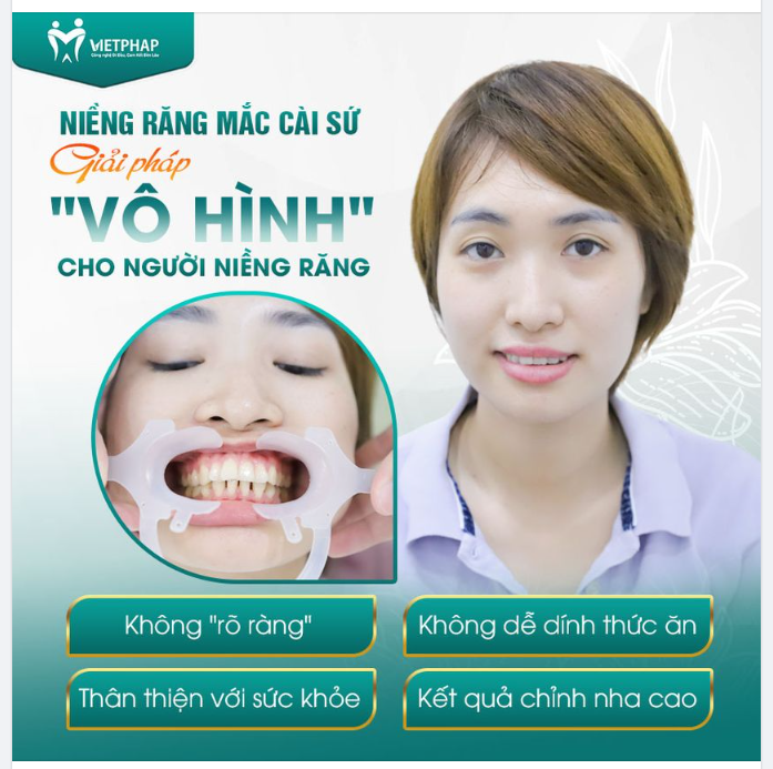NIỀNG RĂNG MẮC CÀI SỨ - GIẢI PHÁP VÔ HÌNH CHO NGƯỜI NIỀNG RĂNG