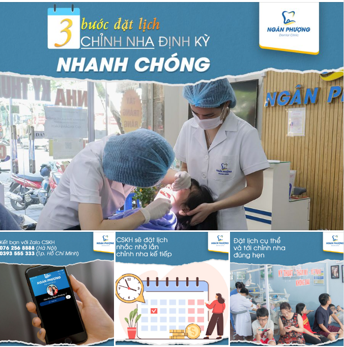 Niềng răng xin chớ vội vàng, chỉnh nha đúng hẹn 2 hàng đẹp xinh