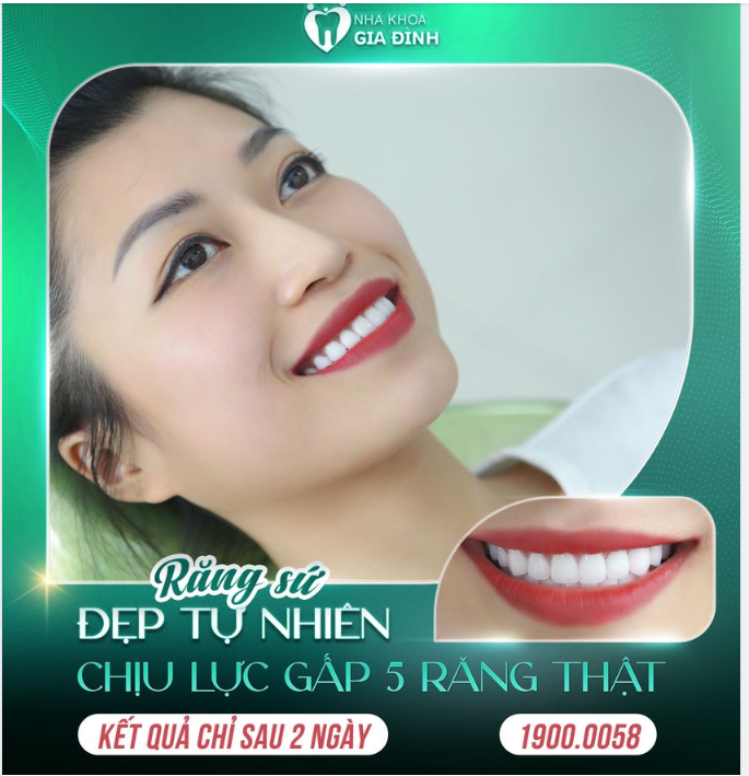 NỤ CƯỜI ĐẸP HOÀN HẢO KHI THẨM MỸ RĂNG SỨ TẠI NHA KHOA GIA ĐÌNH