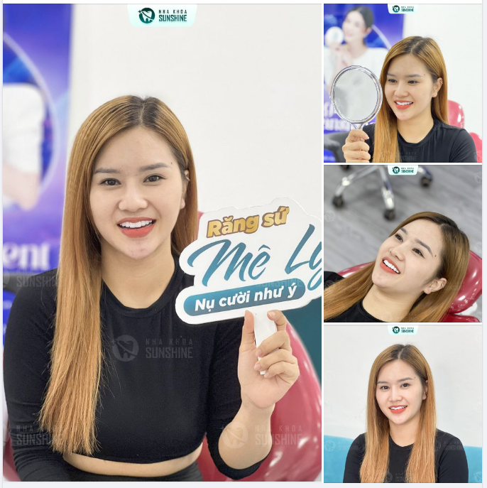 NỤ CƯỜI LUNG LINH TỰ TIN TỎA SÁNG