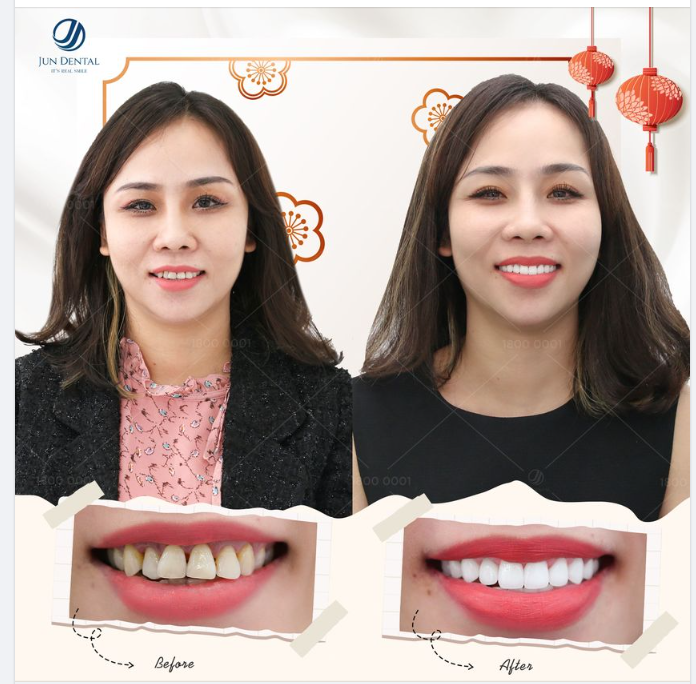 NỤ CƯỜI NHƯ MƠ - THAY ĐỔI BẤT NGỜ