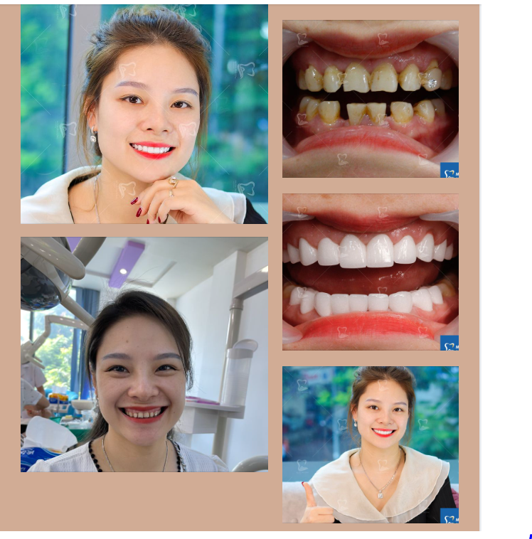 NỤ CƯỜI NHƯ MƠ - THAY ĐỔI BẤT NGỜ