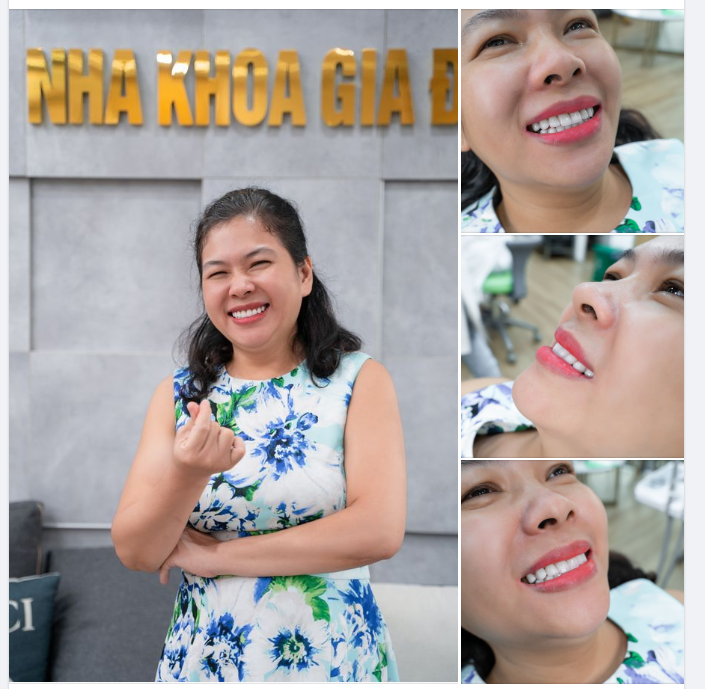 NỤ CƯỜI RẠNG NGỜI - KHÔNG LO TUỔI TÁC️