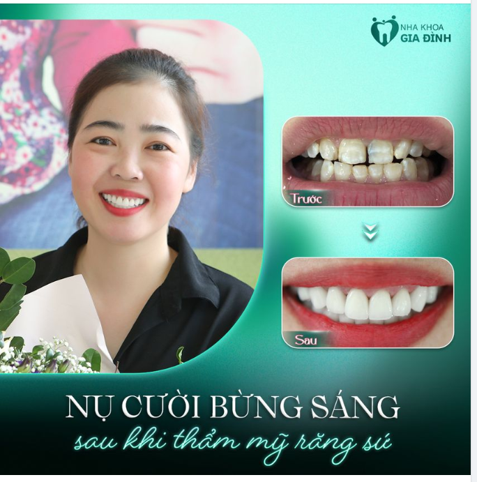 NỤ CƯỜI SÁNG - THANH XUÂN TRỞ LẠI