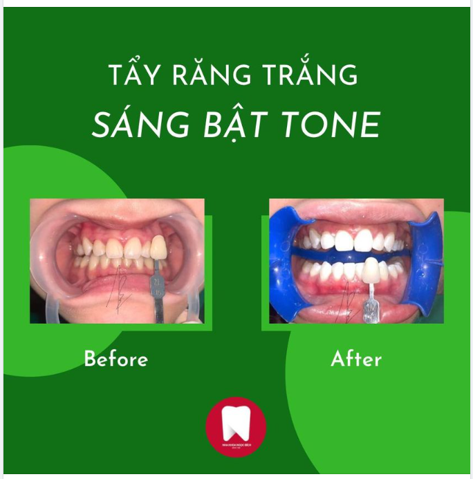 Nụ cười sáng thay đổi diện mạo