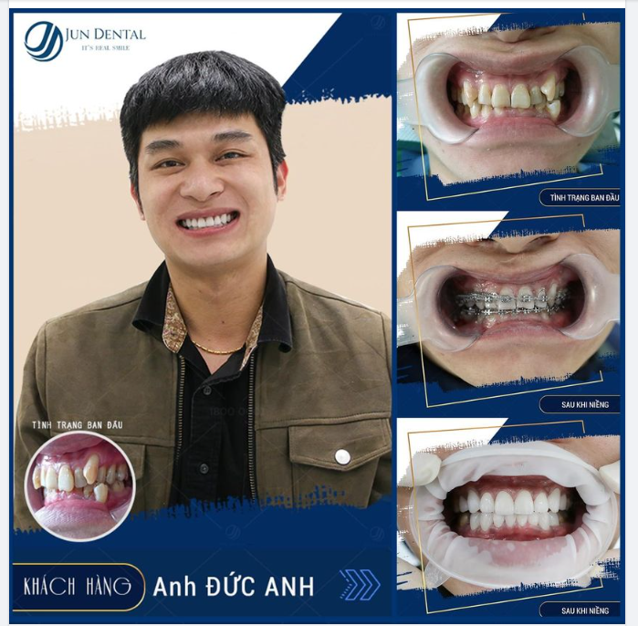 NỤ CƯỜI TƯƠI TẮN YÊU KIỀU TỎA NẮNG
