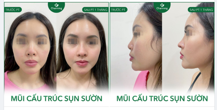 Ở đời, muốn vươn lên thì chúng ta phải có động lực, mũi cũng vậy.