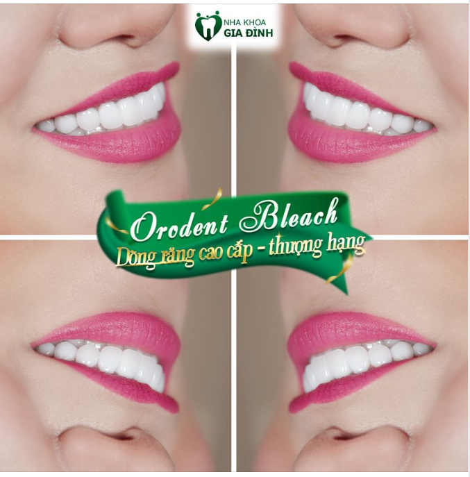 ORODENT BLEACH - DÒNG RĂNG SỨ CAO CẤP, SANG TRỌNG, THƯỢNG HẠNG