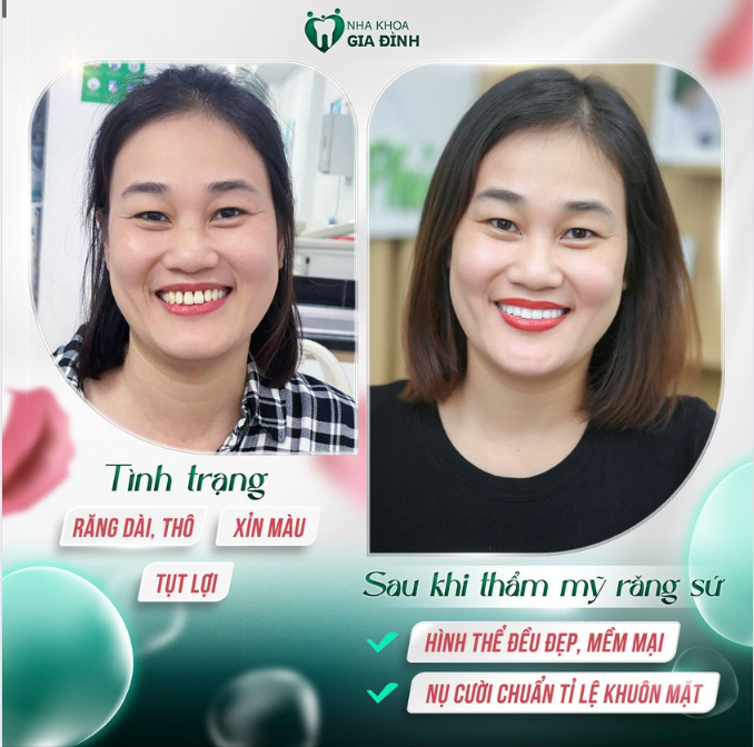 PHỤ NỮ CÓ THỂ ĐẸP HƠN NẾU BIẾT LÀM ĐẸP ĐÚNG CÁCH