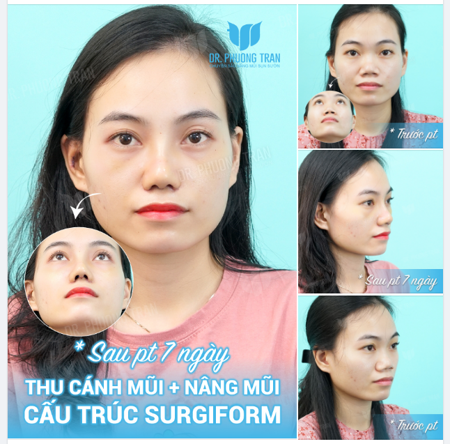 Phụ nữ có thể không tranh giành quyền ưu tiên Nhưng cũng đừng khiến bản thân trở thành sự lựa chọn!