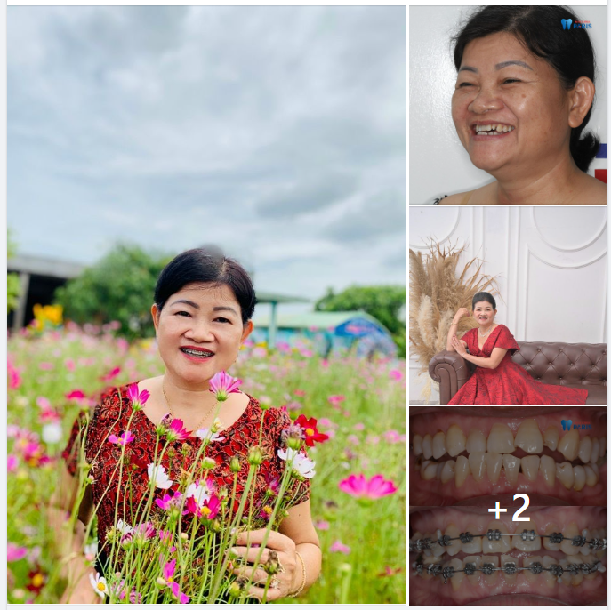“Phụ Nữ Làm Đẹp Không Bao Giờ Là Muộn”
