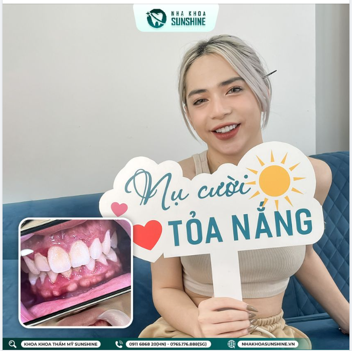 RĂNG ĐẸP CHO NỤ CƯỜI RẠNG RỠ