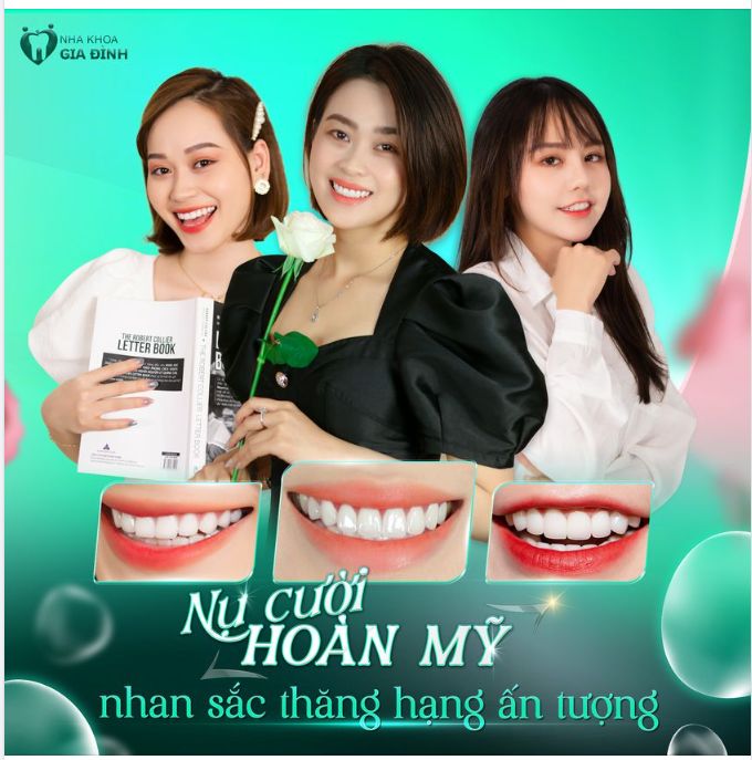 RĂNG ĐẸP THẾ NÀY TẠI SAO BẠN CÒN CHƯA ĐI LÀM?