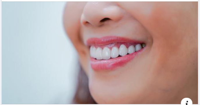 RĂNG HỎNG HẾT ĐẾN NHA KHOA GIA ĐÌNH VÀ CÁI KẾT