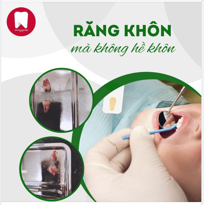 RĂNG KHÔN MÀ LẠI KHÔNG HỀ KHÔN