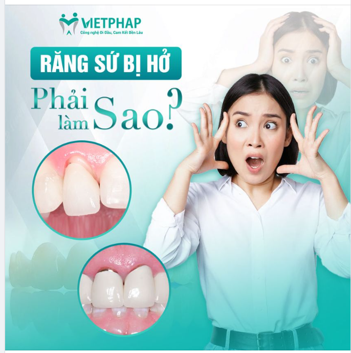 RĂNG SỨ BỊ HỞ PHẢI LÀM NHƯ THẾ NÀO?