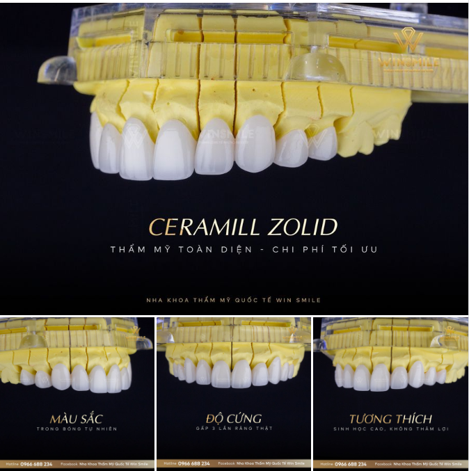 RĂNG SỨ CERAMILL - THẨM MỸ TOÀN DIỆN, CHI PHÍ TỐI ƯU