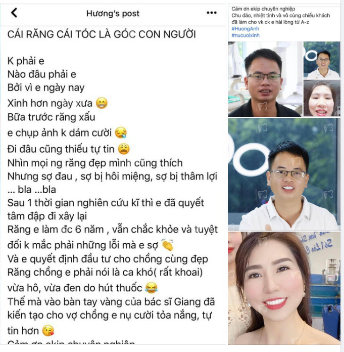 Răng sứ đẹp xinh - Một nhà lung linh